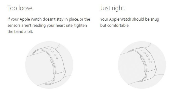 Applewatch