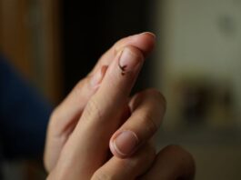 Semnul acesta de pe unghii pus de obicei pe seama unei lovituri merită uneori un consult adevărat